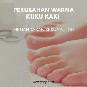 Read more about the article Perubahan Warna Kuku Kaki, Menandakan Sesuatu Loh.!